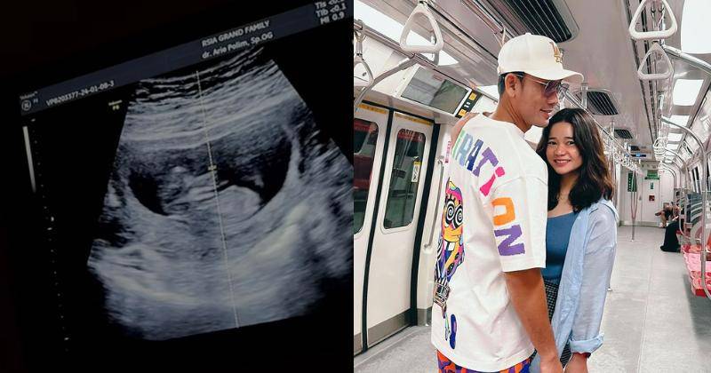 Sedang Hamil, Olivia Tak Mau Denny Sumargo Lihat Perutnya